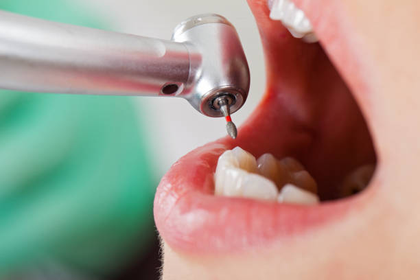 Best Emergency Denture Repair in Leavenworth, WA